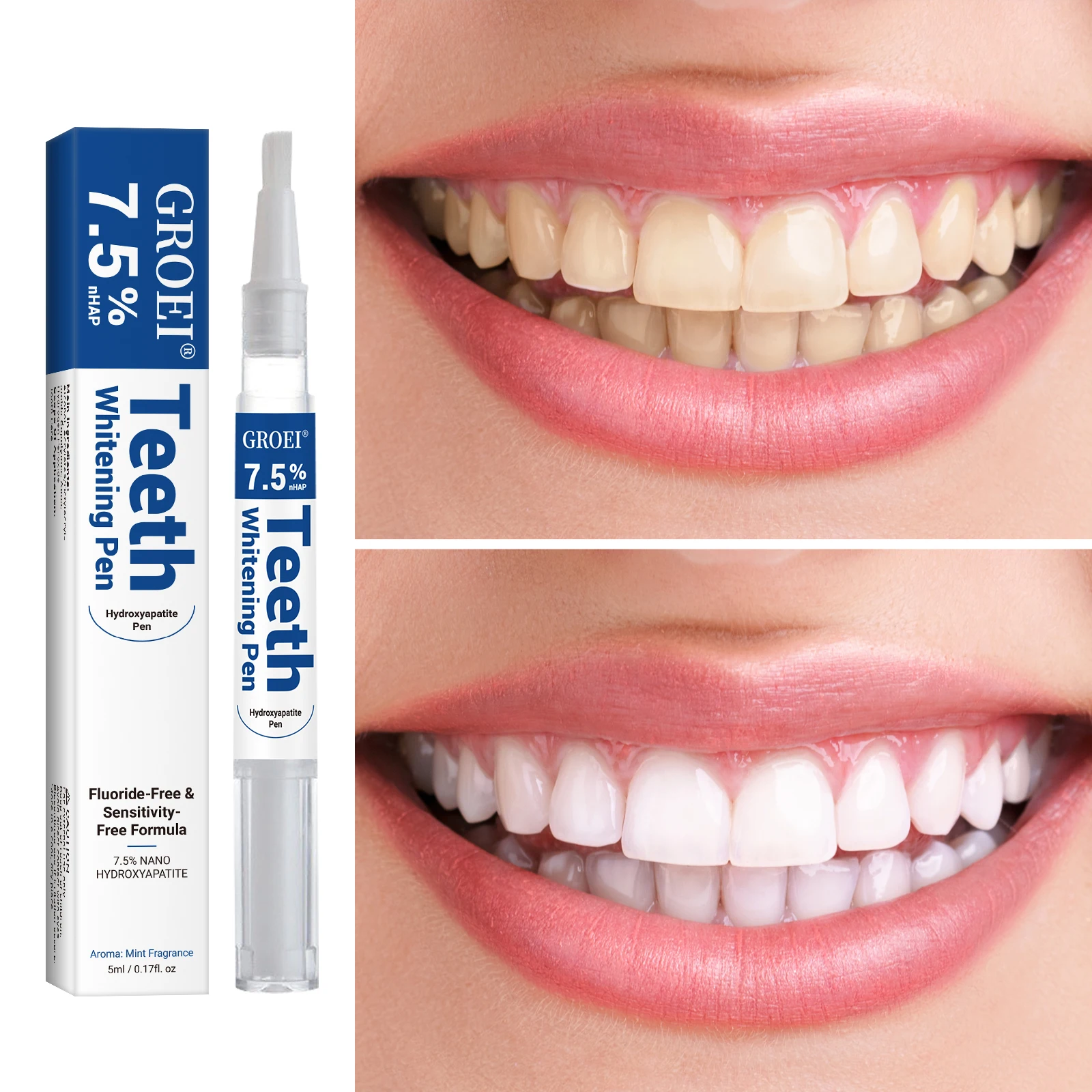 Hydroxyapatite Tooth Whitening – Teeth Whitening With Hydrogen Peroxide Bewertung und Preis