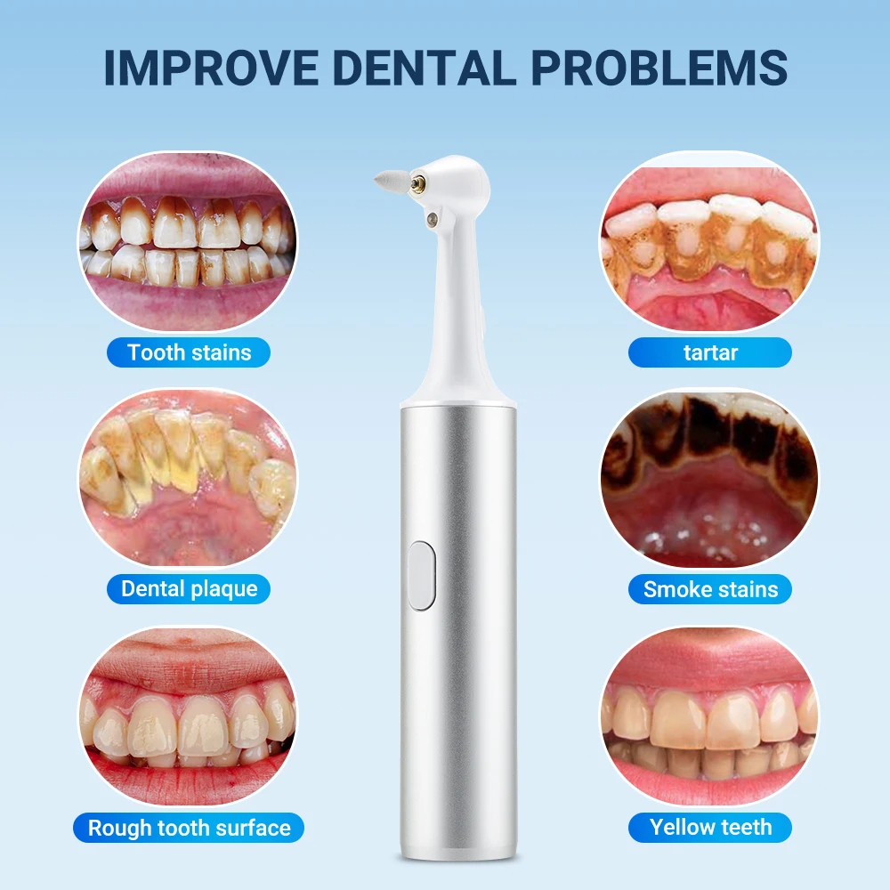 Electric Tooth Cleaner Teeth P – Teeth Whitening Brush Bewertung und Preis