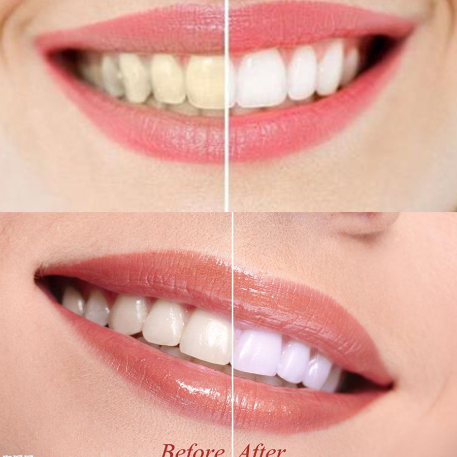 Bamboo Charcoal Teeth Tooth De – Teeth Whitening Yellow Teeth Bewertung und Preis