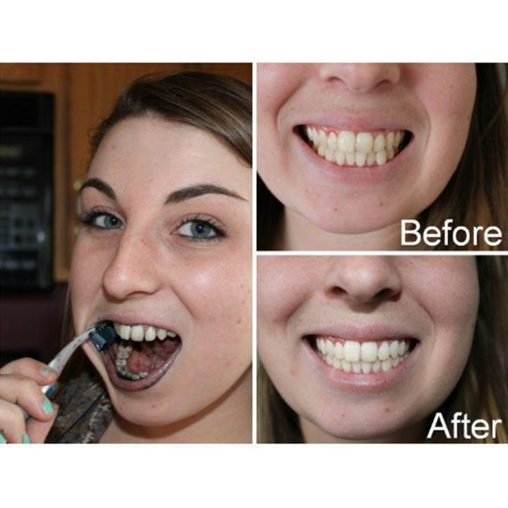 Bamboo Charcoal Teeth Tooth De – Teeth Whitening Yellow Teeth Bewertung und Preis