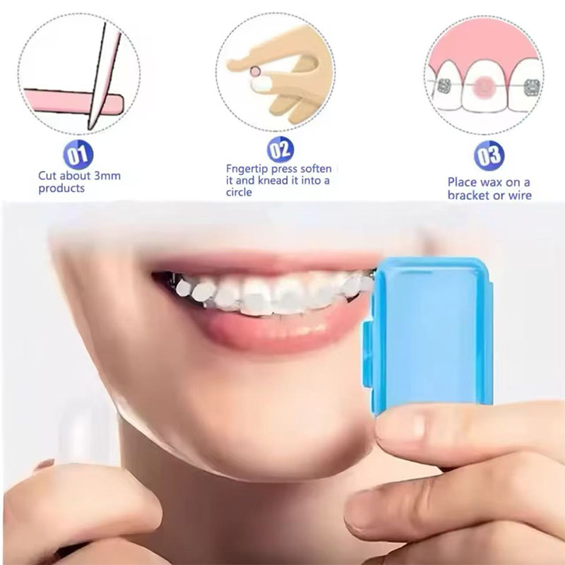 1set Orthodontic Dental Oral C – Teeth Whitening Brush Bewertung und Preis