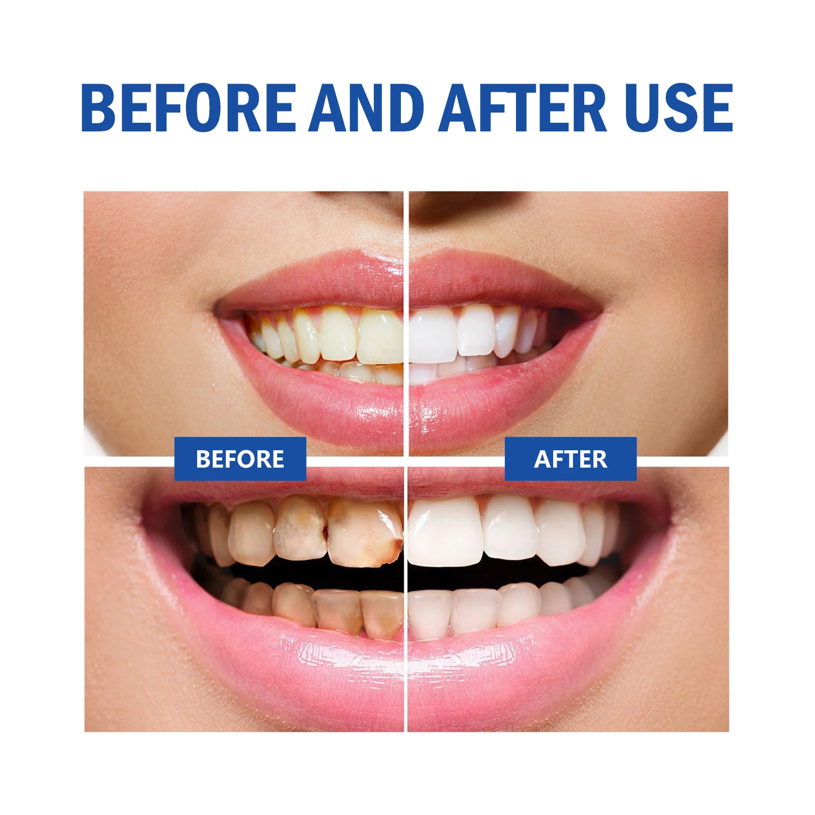 2pcs Gum Repair Gel Spray Deep – Teeth Whitening Xylitol Bewertung und Preis