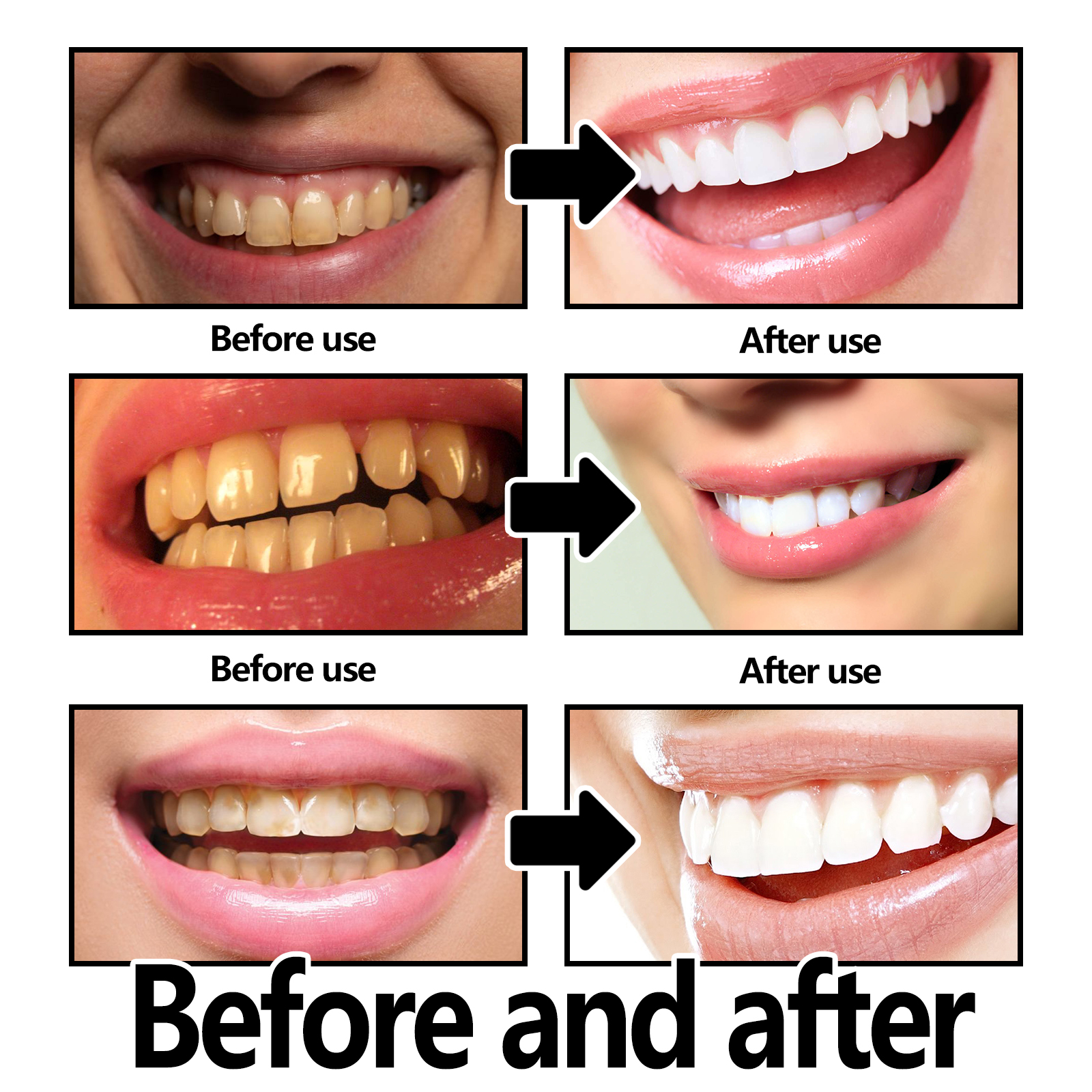 Xylitol Mint Purple Toothpaste – Teeth Whitening Xylitol Bewertung und Preis