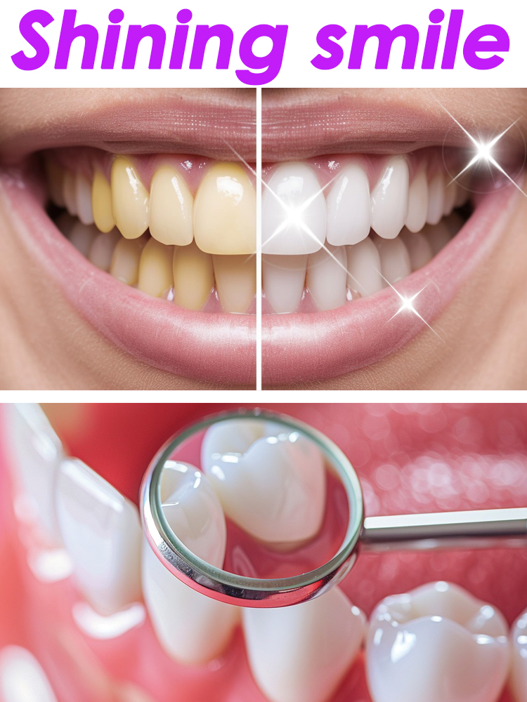GlorySmile Teeth Whitening Fru – Teeth Whitening Xylitol Bewertung und Preis
