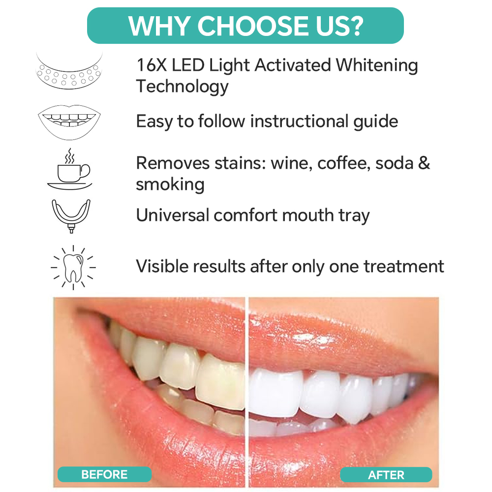 Teeth Whitening Accelerator Li – Teeth Whitening Bleach Bewertung und Preis