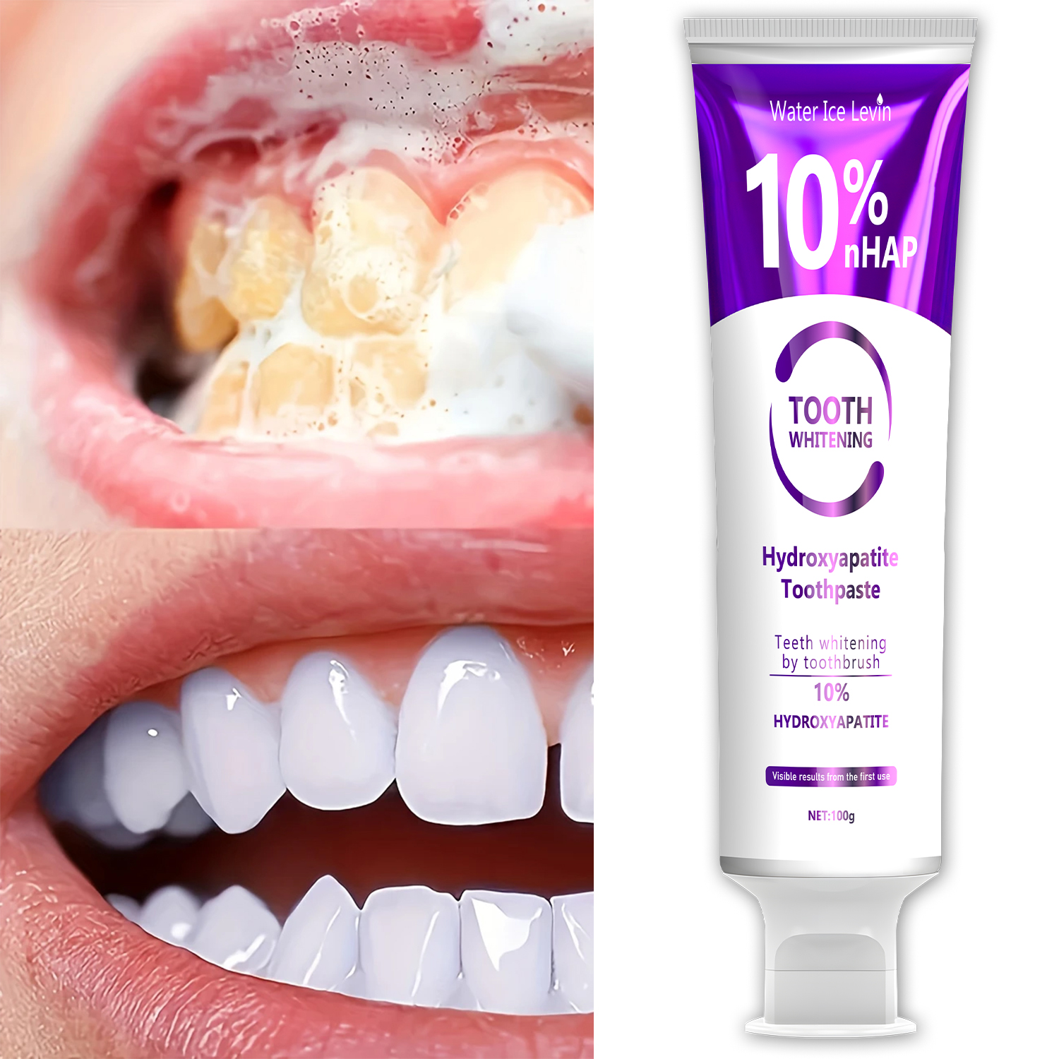 10% Nanoh Hydrogen Oxide Tooth – Teeth Whitening With Hydrogen Peroxide Bewertung und Preis
