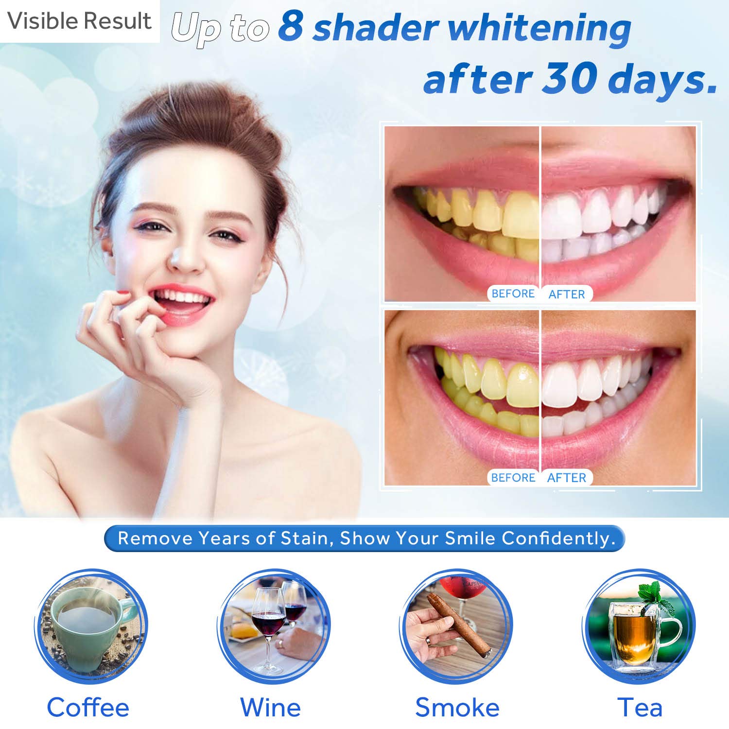 Teeth Whitening Gel Refill Syr – Teeth Whitening Price Bewertung und Preis