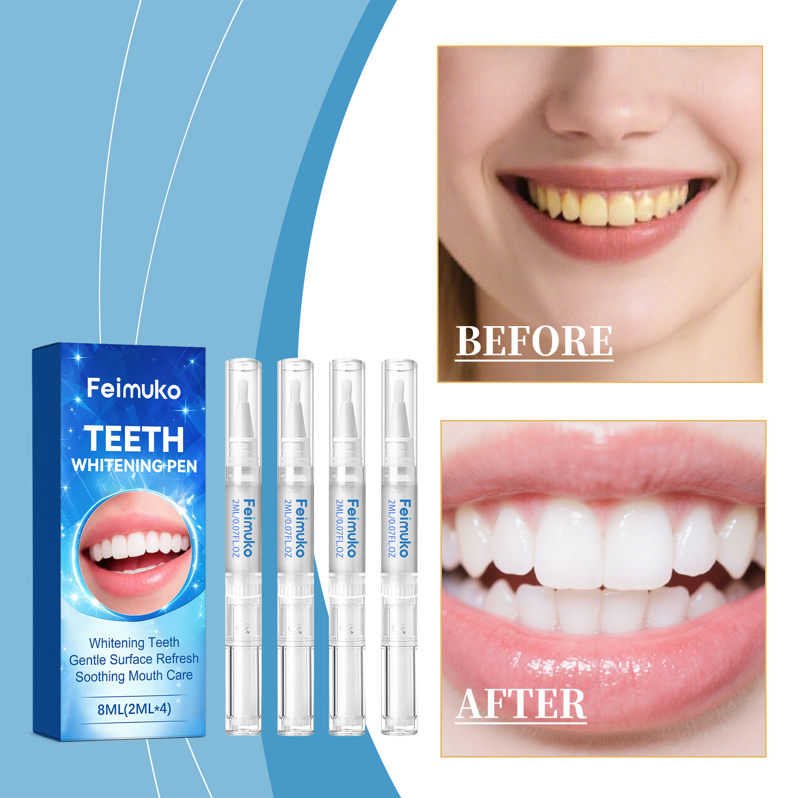 Feimuko 8ml Teeth Gel Pen Gent – Teeth Whitening With Hydrogen Peroxide Bewertung und Preis