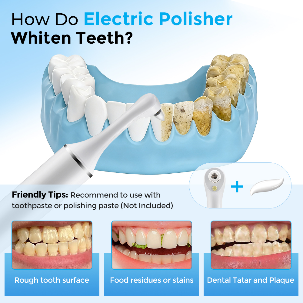 Electric Tooth Polisher Teeth  – Teeth Whitening Brush Bewertung und Preis