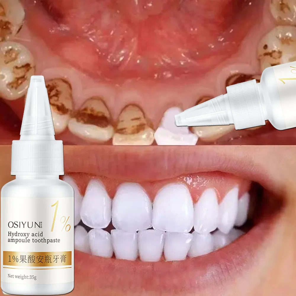 Teeth Whitening Toothpaste Fru – Teeth Whitening Xylitol Bewertung und Preis