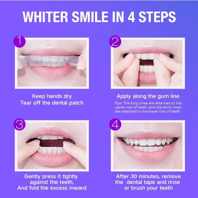 Teeth Whitening Kit - 5X LED L – Teeth Whitening Price Bewertung und Preis