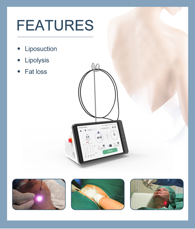 Dental Laser Teeth Whitening D – Teeth Whitening Laser Bewertung und Preis