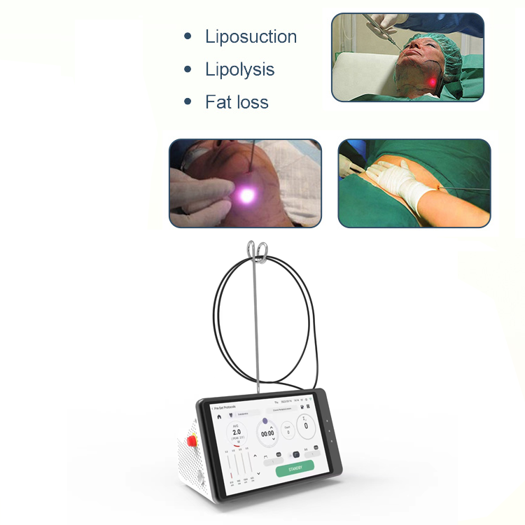 Dental Laser Teeth Whitening D – Teeth Whitening Laser Bewertung und Preis