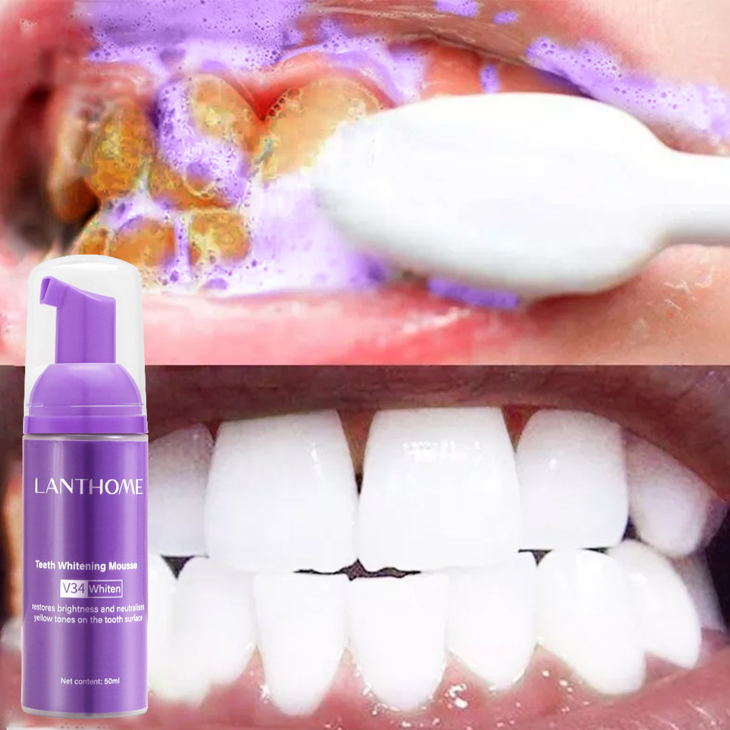 V34 Teeth Whitening Mousse Too – Teeth Whitening Xylitol Bewertung und Preis