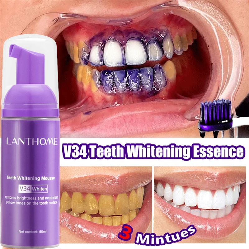 V34 Teeth Whitening Mousse Too – Teeth Whitening Xylitol Bewertung und Preis