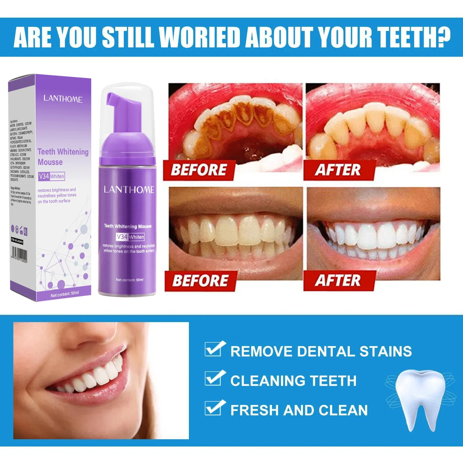 V34 Teeth Whitening Mousse Too – Teeth Whitening Xylitol Bewertung und Preis