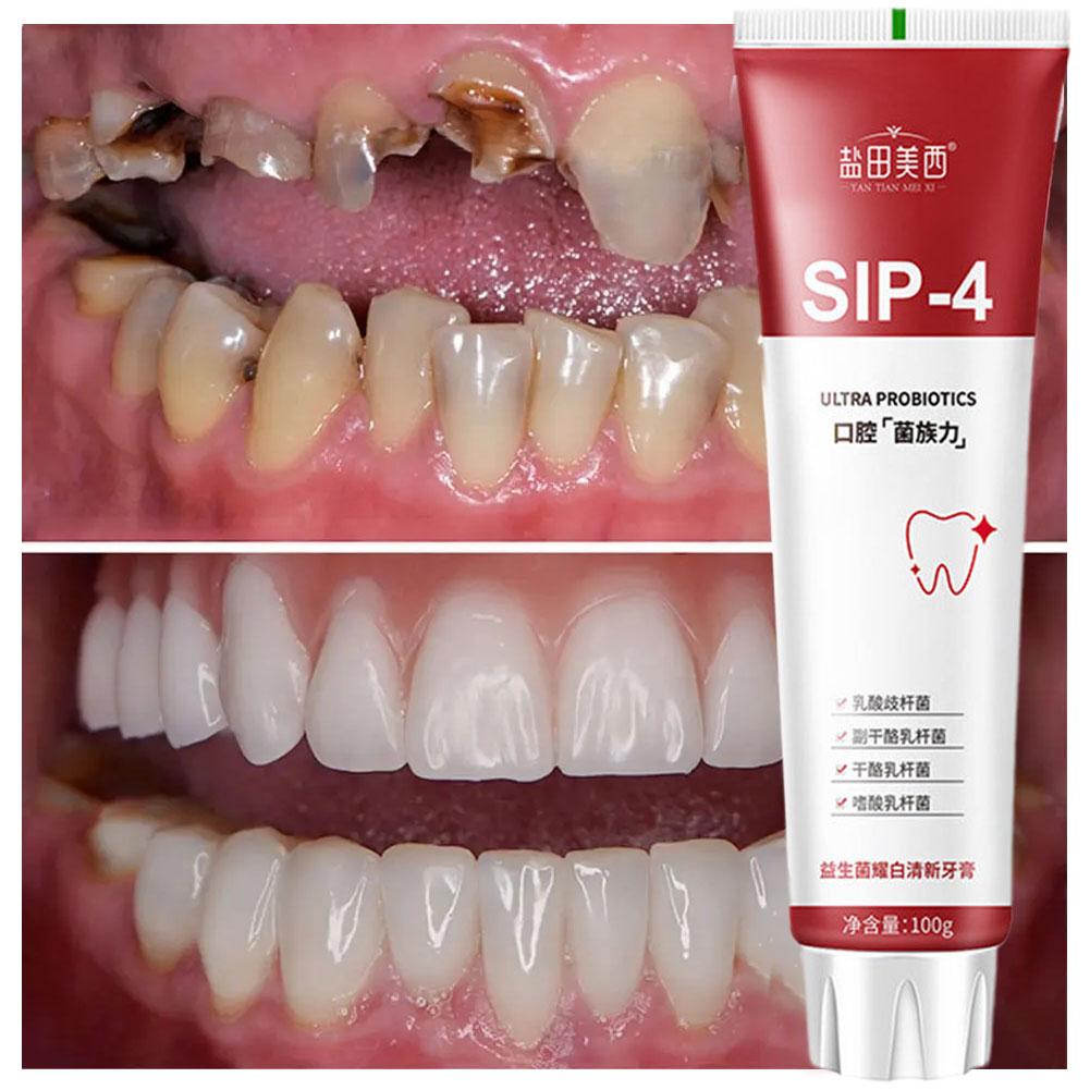 100g Sip-4 Probiotic Whitening – Teeth Whitening Yellow Teeth Bewertung und Preis