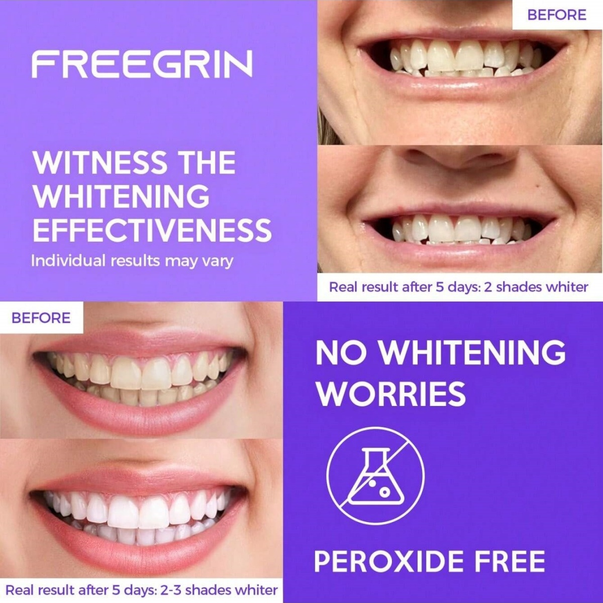 Deluxe Whitening Teeth Sticker – Teeth Whitening With Hydrogen Peroxide Bewertung und Preis