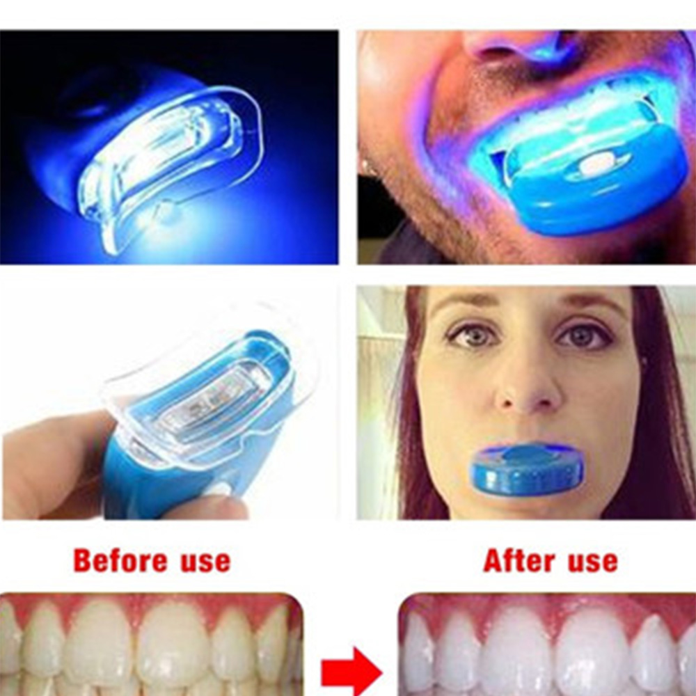 New Blue Led Teeth Whitening A – Teeth Whitening Laser Bewertung und Preis
