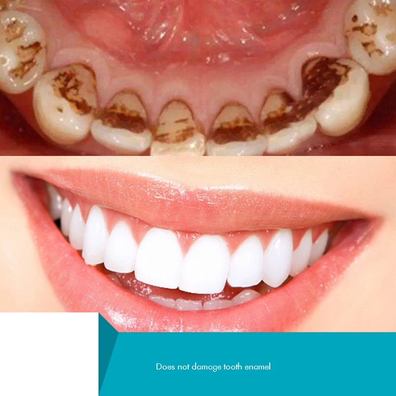 Herbal Tooth Powder, Natural T – Teeth Whitening Xylitol Bewertung und Preis