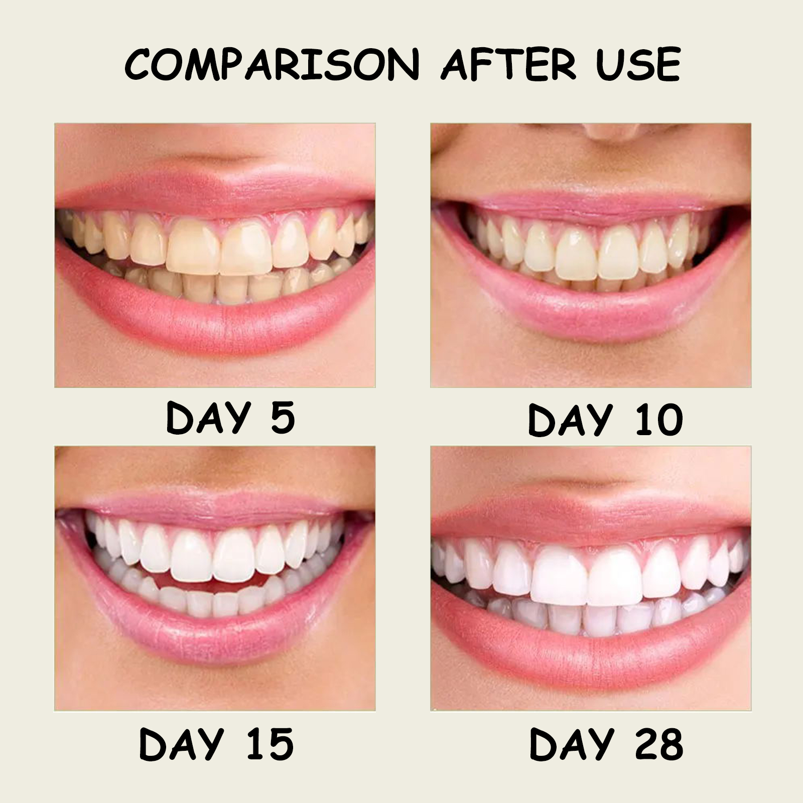 Xylitol Mint Toothpaste Teeth  – Teeth Whitening Xylitol Bewertung und Preis