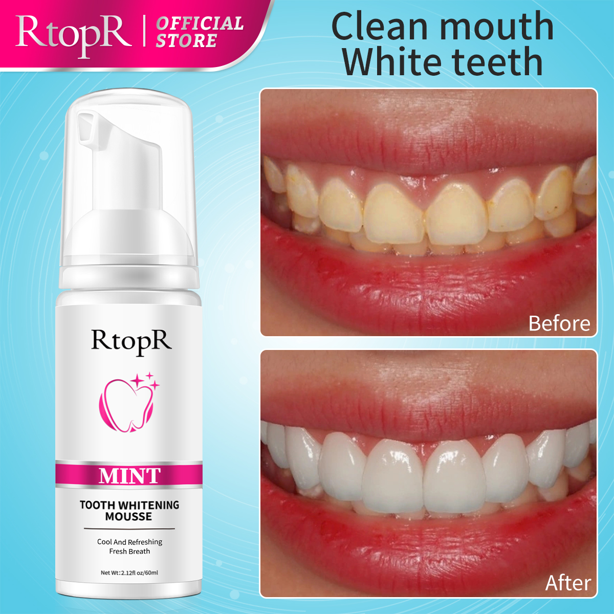 RtopR Mint Whitening Teeth Mou – Teeth Whitening Xylitol Bewertung und Preis