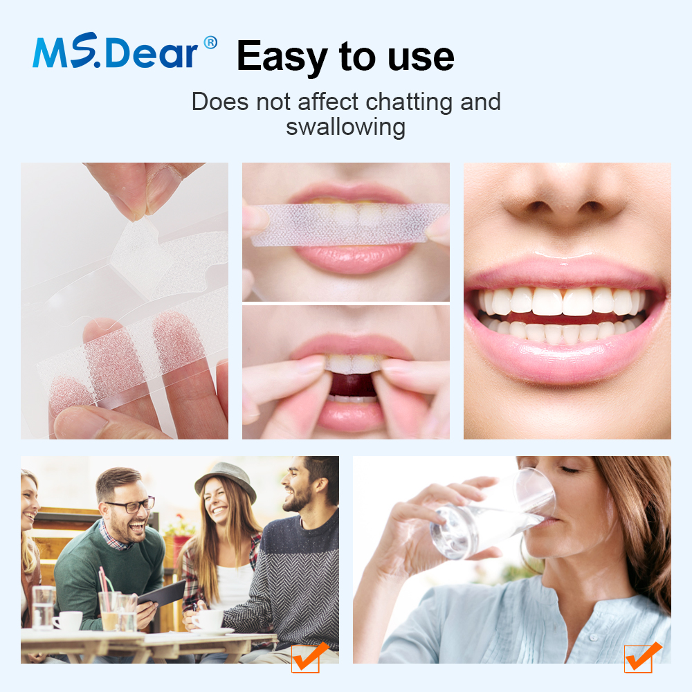 Teeth Whitening Strips Cleansi – Teeth Whitening Price Bewertung und Preis